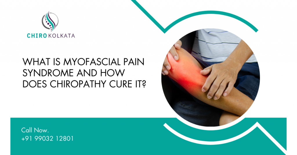 Myofascial Pain Syndrome Treatment in Kolkata Chiro Kolkata